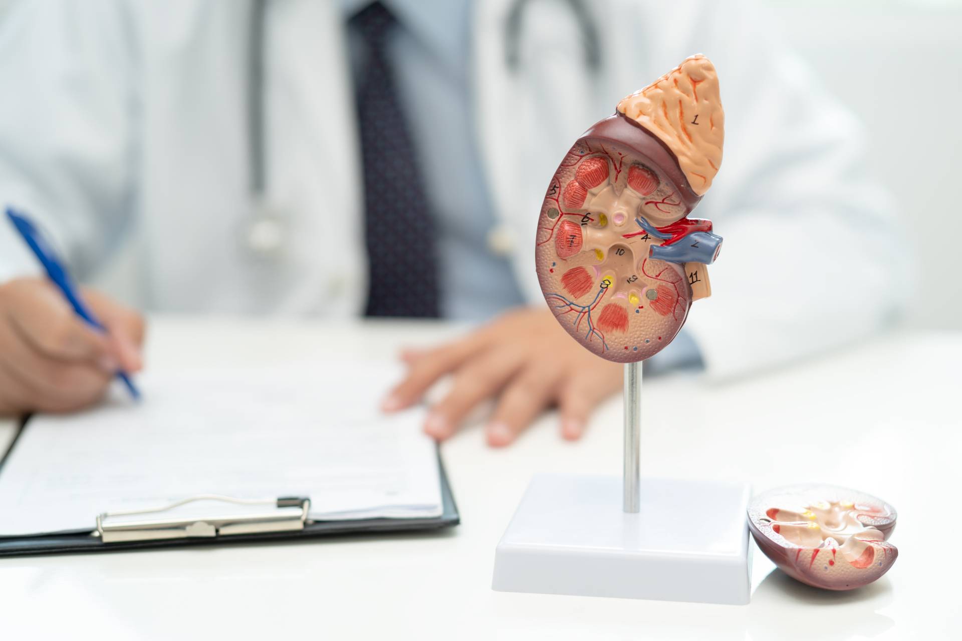 Kidney disease, Chronic kidney disease ckd, Doctor with human model to study and treat in hospital.